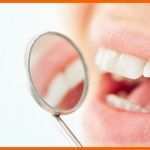 Erstaunlich 53 Best Von Erstattung Zahnreinigung Vorlage
